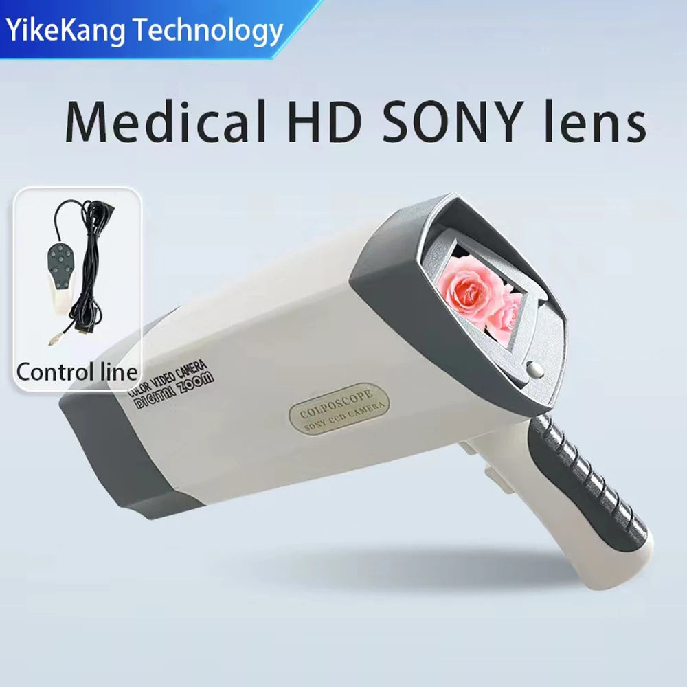 Digital Colposcope with Screen, High Definition Color Imaging, Gynecology Examination Equipment for Clinic