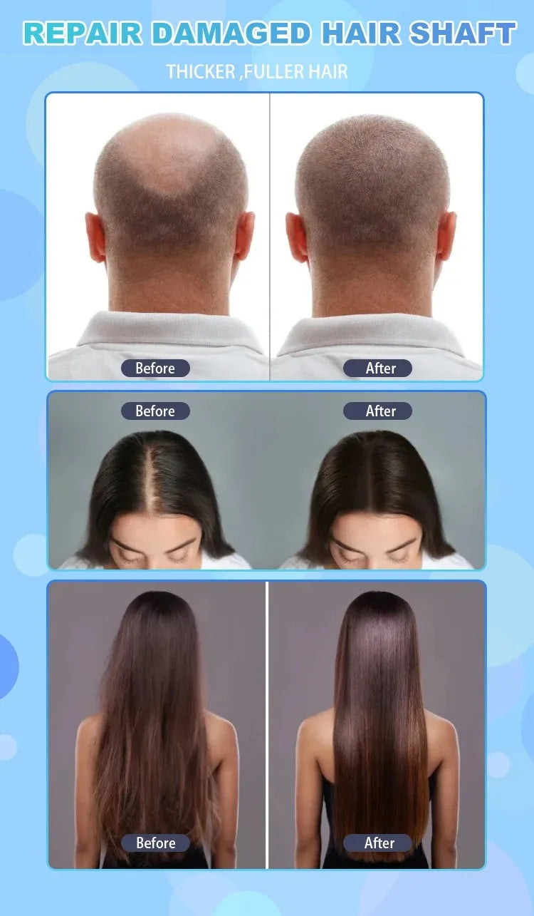 Silicone Scalp Massager Electric Brush for Hair Growth Red Light Therapy Hair and Scalp Analysis Machine