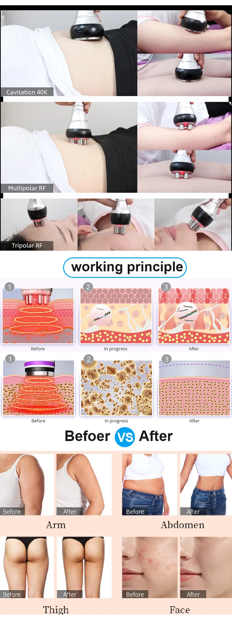 Moonic 3in1 Slimming Massage Cavitation Machine Multifunctional Equipment Facial Body Tightening Lifting Skincare Tool