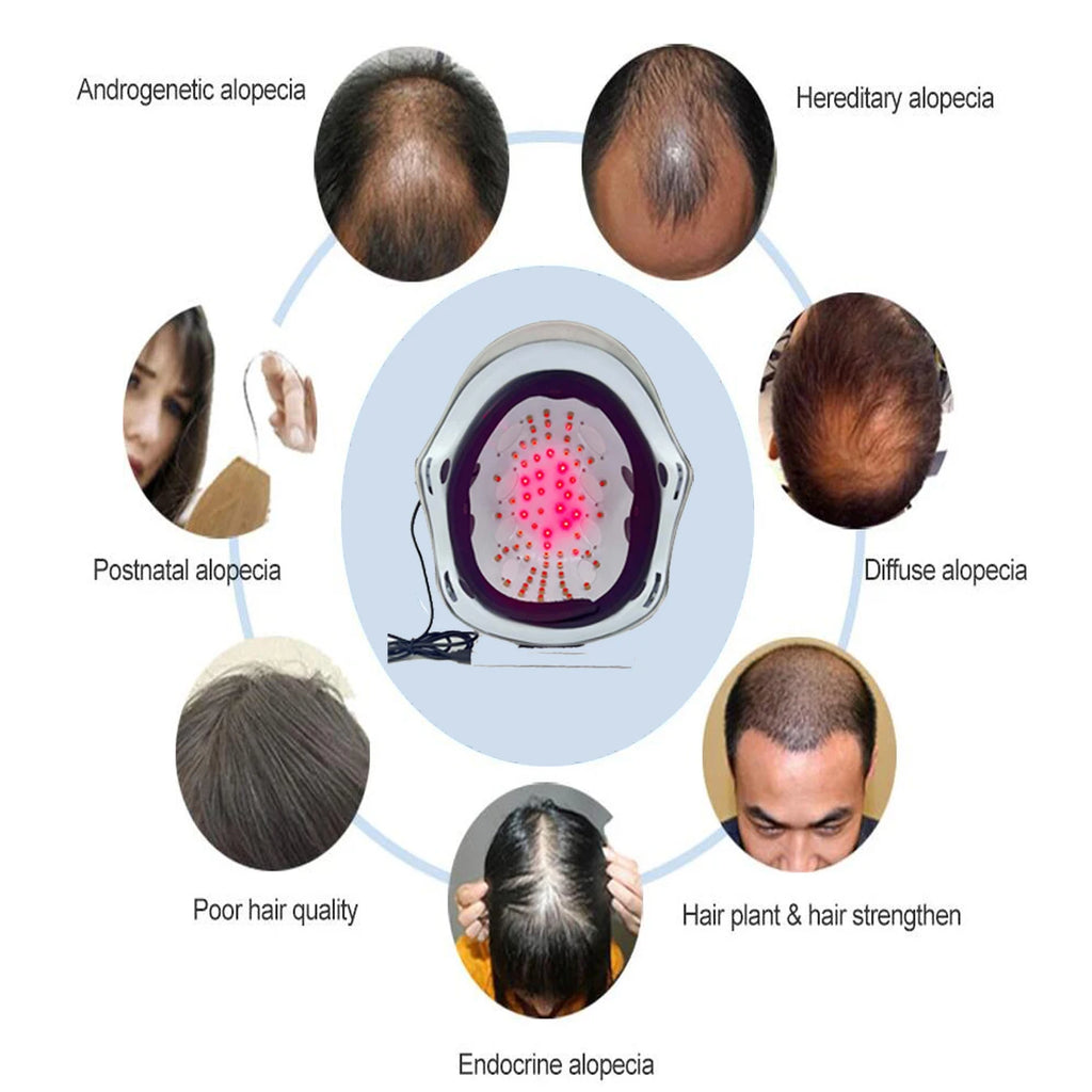 black diode laser LLLT low leve laser 650nm hair growth products