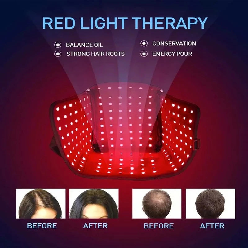 Red Light And Infrared Light Hair Growth Cap Led Red Light Treatment For Hair Loss - Promotes Rapid Hair Regrowth