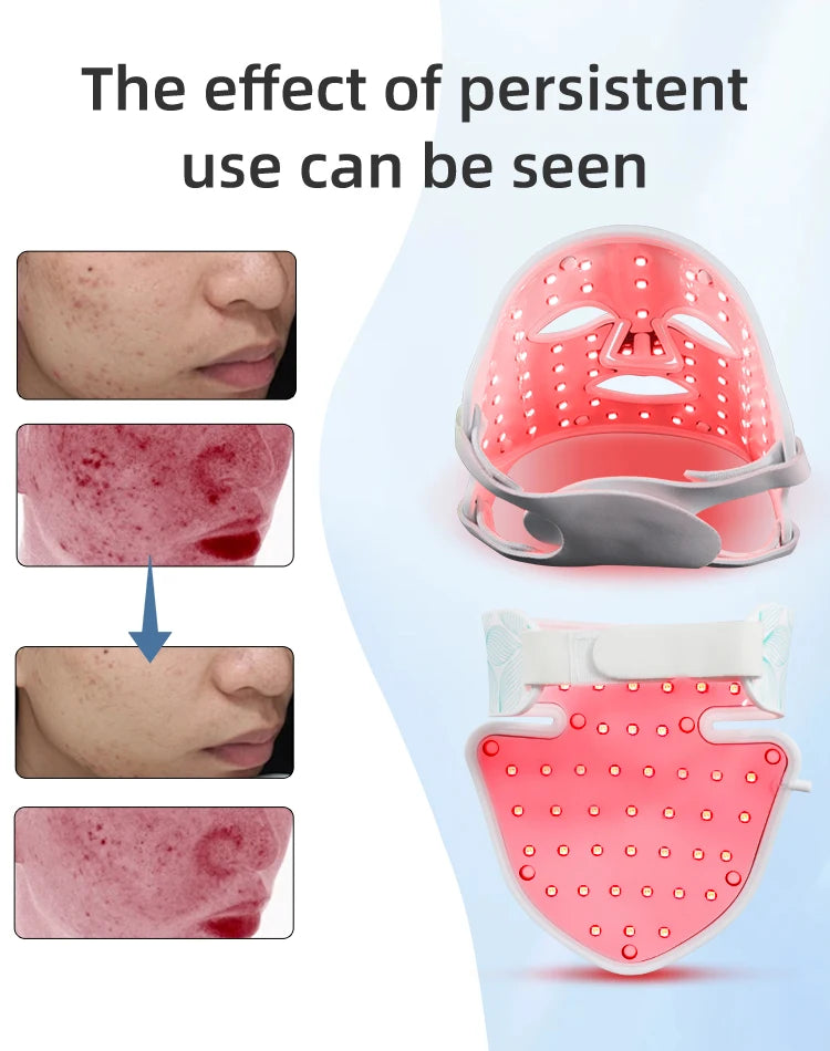 7 Colors + Infrared LED Face Mask and Neck Red Light Therapy Anti Aging Wrinkle Acne Pore Oil Control Skin Tighten Whiten