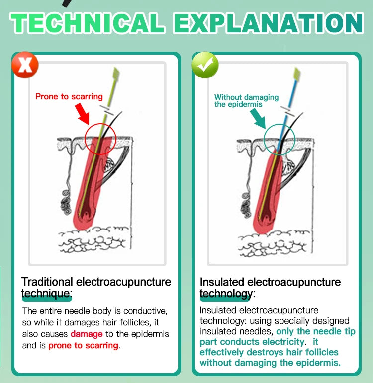 2025 Portable Electrolysis Epilators Removal Device Painless Electrolysis Machine Electric Needle Hair Removal for Men