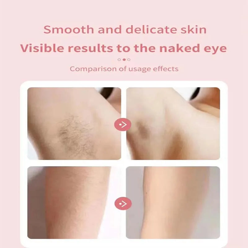 Electric shaver, women's hair repair device, portable charging hair removal kit, women's body hair shaving tool