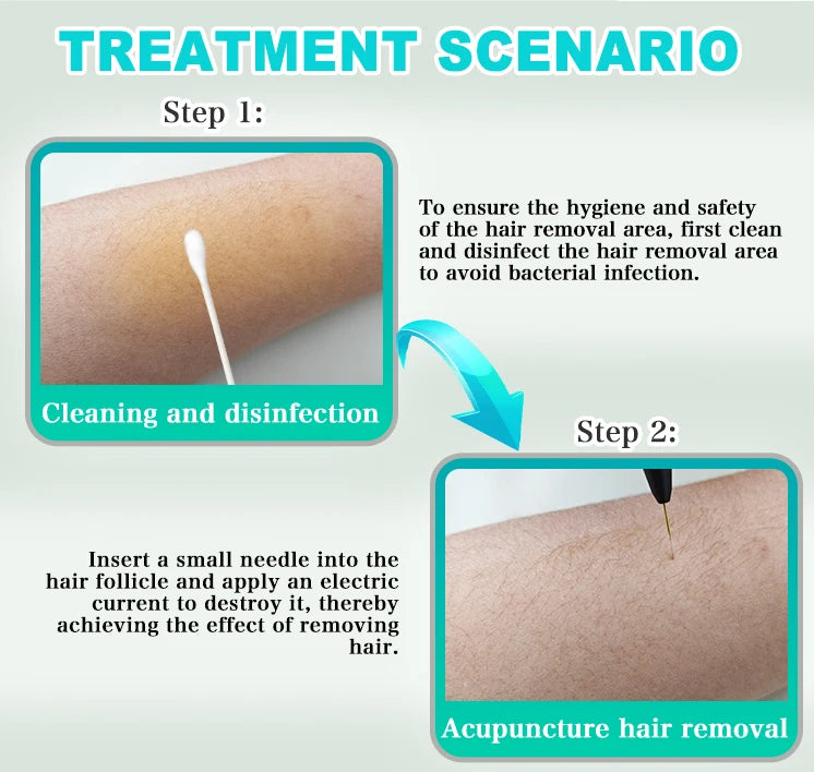 2025 Portable Electrolysis Epilators Removal Device Painless Electrolysis Machine Electric Needle Hair Removal for Men