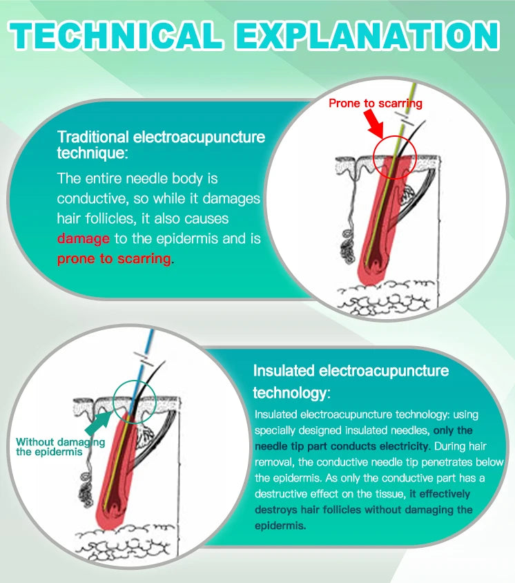 2025 Portable Electrolysis Epilators Removal Device Painless Electrolysis Machine Electric Needle Hair Removal for Men