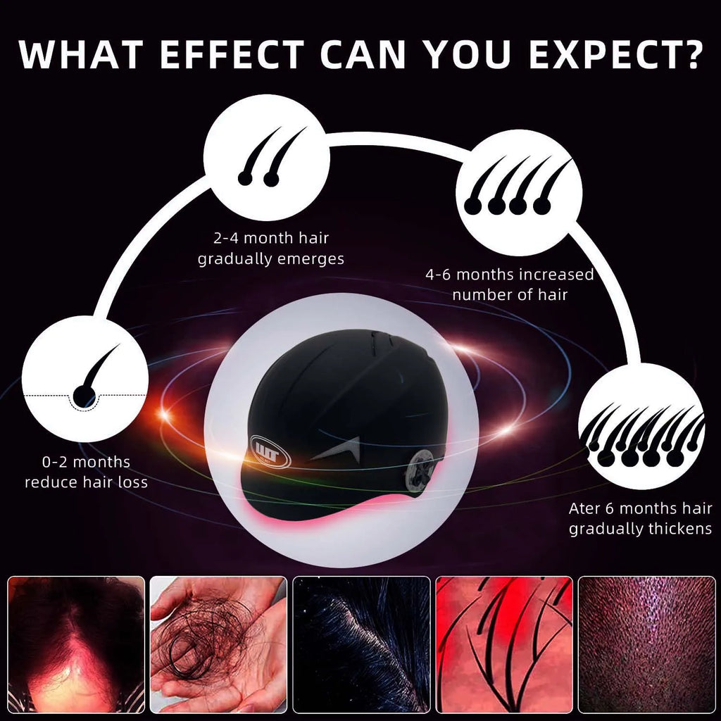 black diode laser LLLT low leve laser 650nm hair growth products