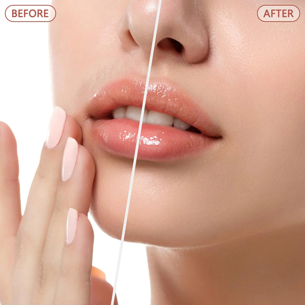 Facial Hair Remover for Women - as Seen on TV Painless Face Shaver - Electric Hair Removal Device for Face Lips Peach Fuzz