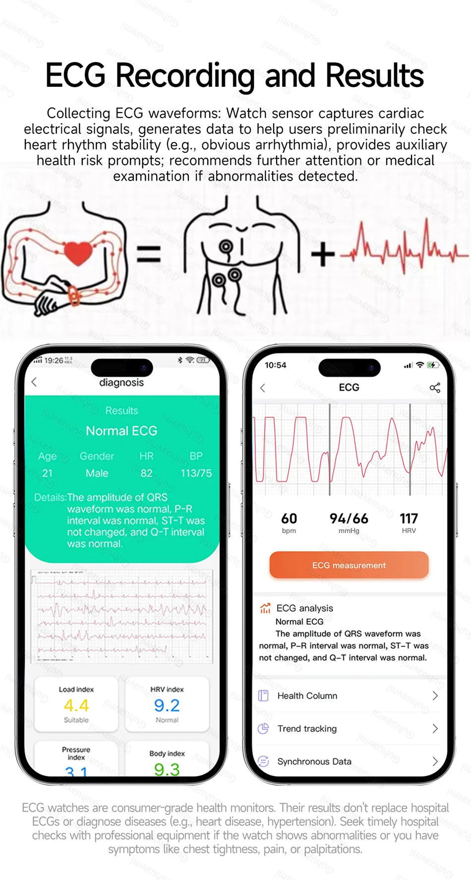 Smart Watch 650nm Dual probe laser health conditioning Blood oxygen Pressure Uric Acid Blood lipid ECG Smartwatch for Man Women
