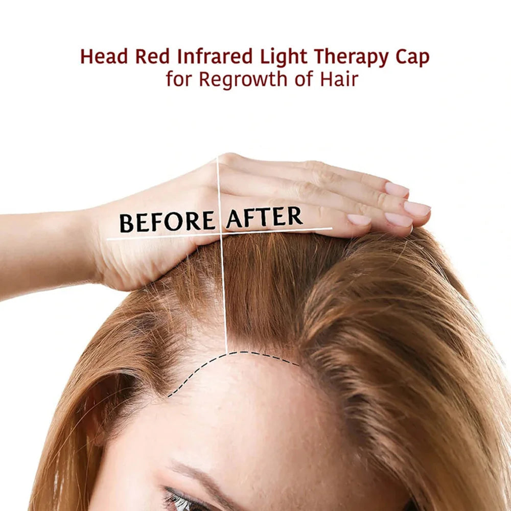 Red Light And Infrared Light Hair Growth Cap Led Red Light Treatment For Hair Loss - Promotes Rapid Hair Regrowth